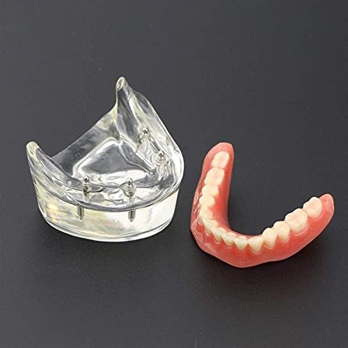 RRGJ Model podučavanja, Anatomijski model zuba Model zubnih zuba - Model demonstracije zuba - Model Demontalne skrbi - Model